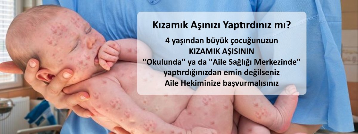 Kızamık Aşınızı Oldunuz mu? 